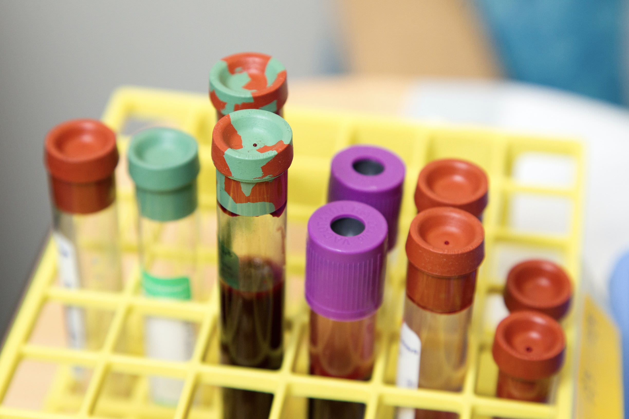 national-cancer-blood vials